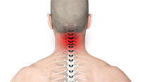 Neck Pain