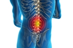 Early physical therapy benefits low-back pain patients