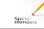 Reducing Your Risk of Developing Age-Related Spinal Stenosis