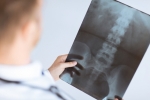 Should You Consider Revision Spine Surgery?