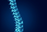 What Causes Spinal Stenosis?