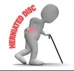 What You Can Do to Help Prevent Herniated Discs